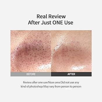 Blackhead Melting Clear Pad