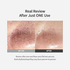 Blackhead Melting Clear Pad