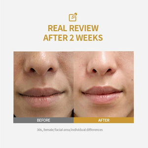 Silk Peptide Intensive Lifting Ampoule