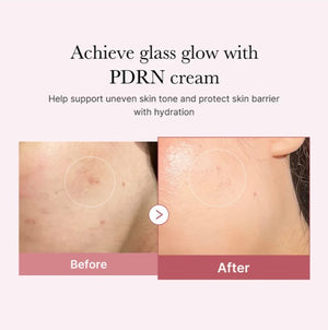 PDRN Pink Hyaluronic Cream